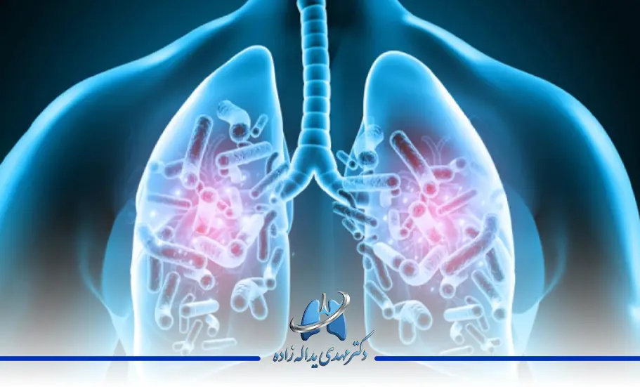 عفونت ریه چیست؟ | مهمترین علائم آن