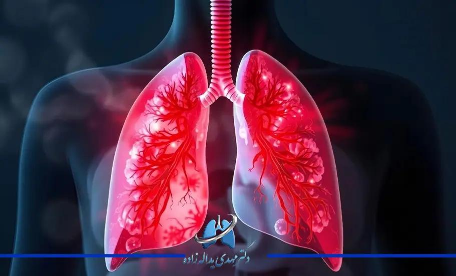 سرفه مزمن چیست؟ علائم، علت و درمان سرفه مزمن در کودکان و بزرگسالان